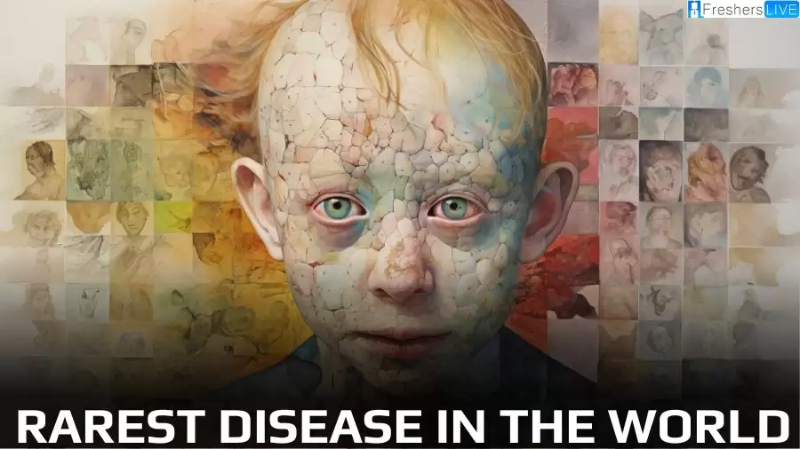 Rarest Disease in the World - Top 10 Listed